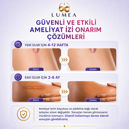 Lumea Ameliyat İz Bandı — Premium Silikon Rulo Bant | Tıbbi Sınıf