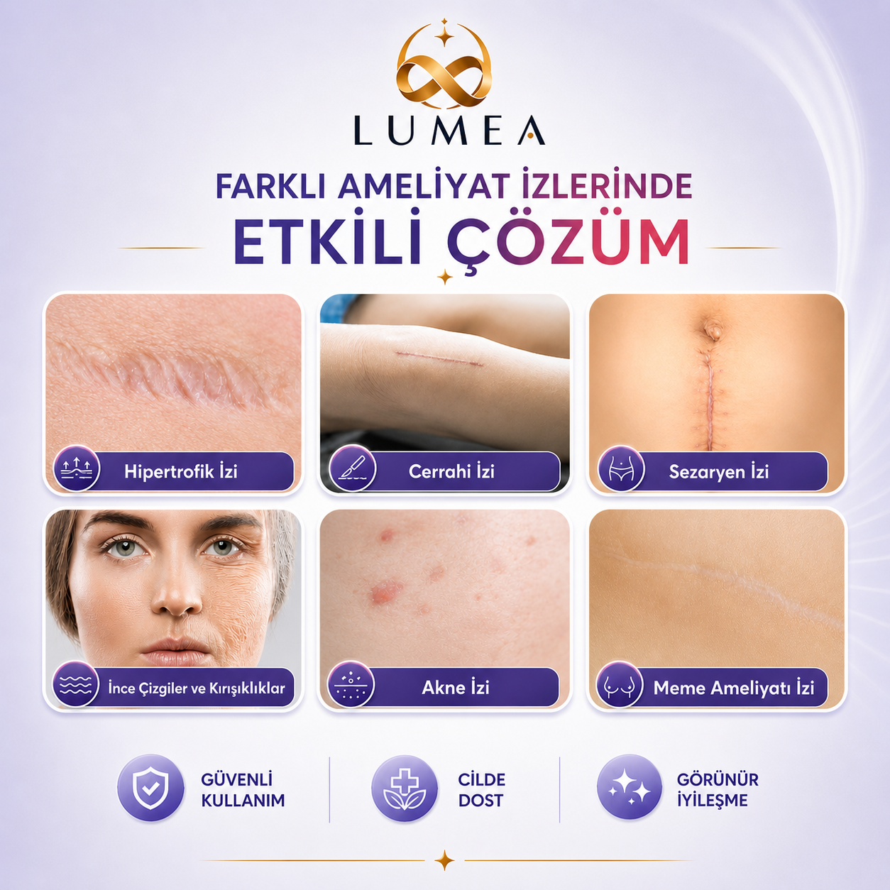 Lumea Ameliyat İz Bandı — Premium Silikon Rulo Bant | Tıbbi Sınıf