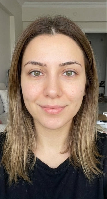 files/Woman_showing_skin_improvement_9c37c12de3.jpg